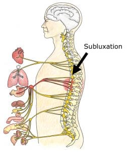 Ask the Chiropractor: What is a Subluxation and How Does it Affect Me?
